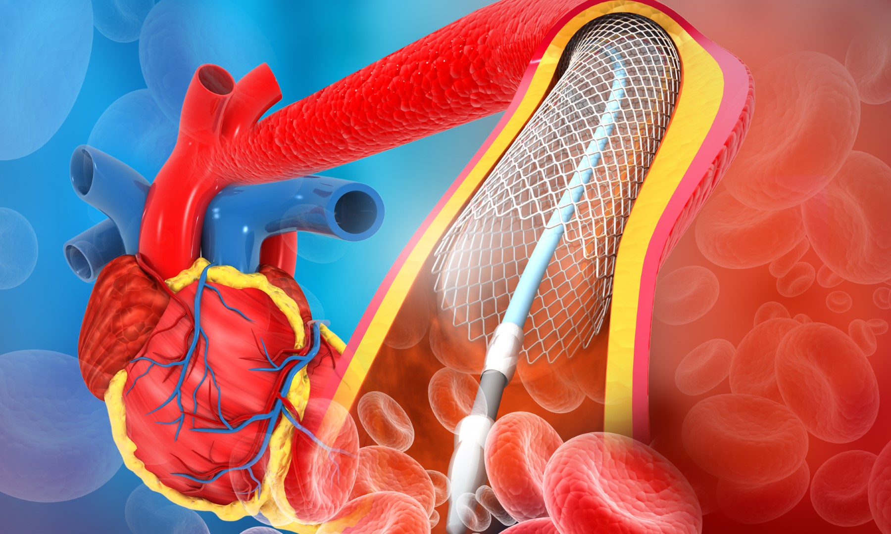 Cardiology / Angiology Online Consultations – OHC - Wiener Privatklinik